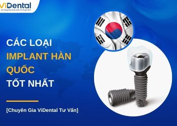 Các loại Implant Hàn Quốc tốt nhất