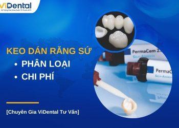 Các loại keo dán răng sứ