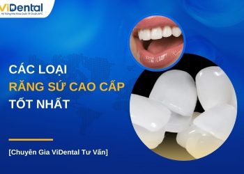 Các loại răng sứ cao cấp tốt nhất