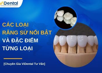 Các loại răng sứ nổi bật