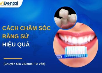 Cách chăm sóc răng sứ hiệu quả