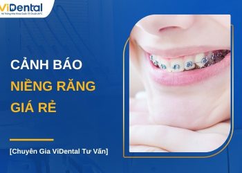 Cảnh báo niềng răng giá rẻ