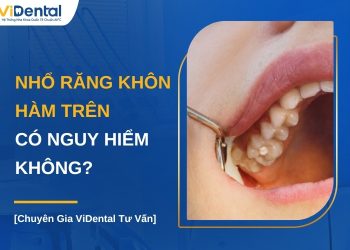 Nhổ răng khôn hàm trên có nguy hiểm không