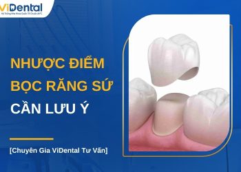 Nhược điểm bọc răng sứ có thể bạn chưa biết