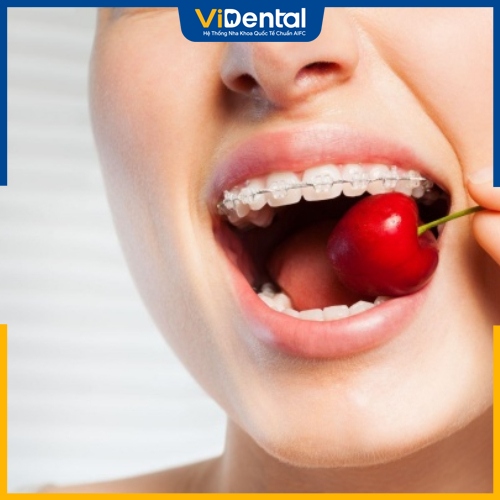 Chú ý ăn uống đầy đủ dinh dưỡng để không bị hóp má khi niềng răng