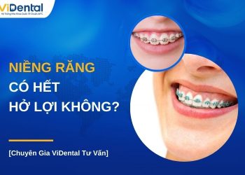 Niềng răng có hết hở lợi không