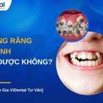 nieng-rang-khenh-co-duoc-khong