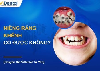 nieng-rang-khenh-co-duoc-khong