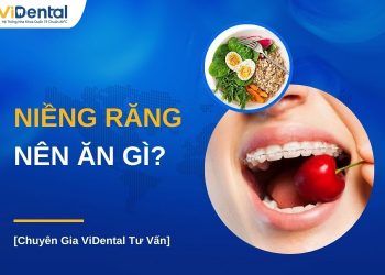 Niềng răng nên ăn gì