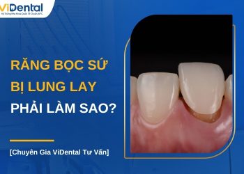 Răng bọc sứ bị lung lay phải làm sao