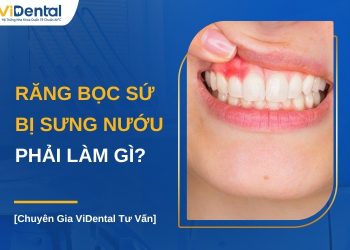 Răng bọc sứ bị sưng nướu phải làm gì