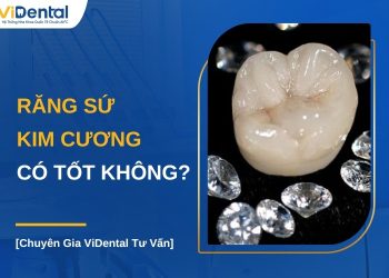 Răng sứ kim cương có tốt không