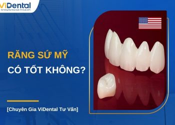 Răng sứ Mỹ có tốt không