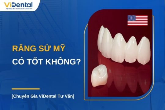 Răng sứ Mỹ có tốt không