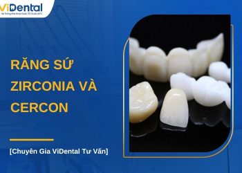 So sánh răng sứ Zirconia và Cercon