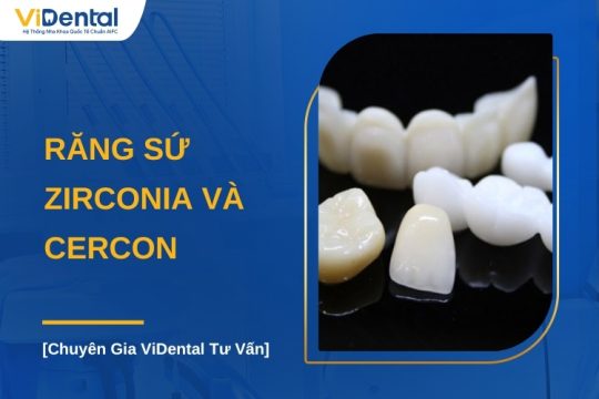 So sánh răng sứ Zirconia và Cercon