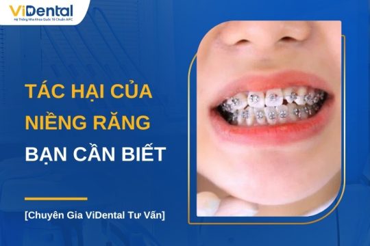 Tác hại của niềng răng bạn nên biết