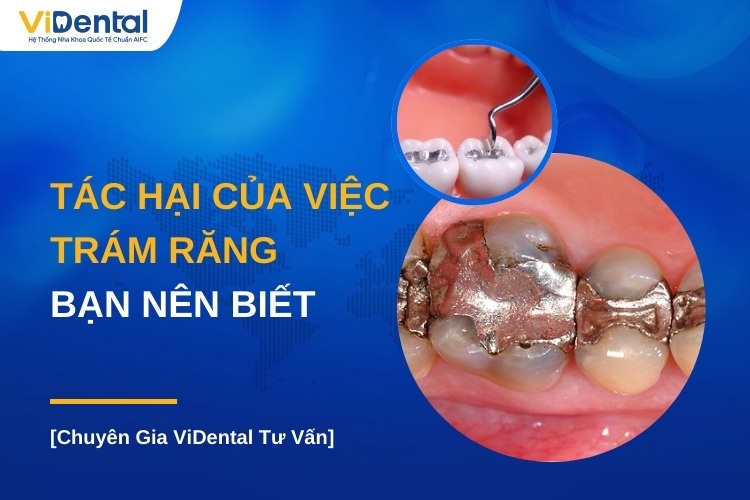 TÁC HẠI CỦA VIỆC TRÁM RĂNG CÓ THỂ XẢY RA NẾU THỰC HIỆN KHÔNG ĐÚNG CÁCH