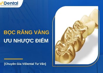 Ưu nhược điểm bọc răng vàng