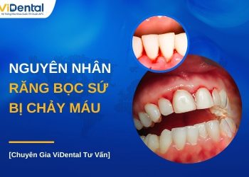 Vì sao răng bọc sứ bị chảy máu