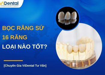 Bọc răng sứ 16 răng loại nào tốt