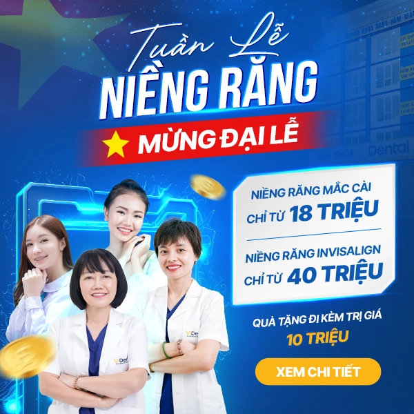 banner-nieng-30-4-mobile