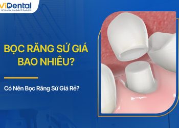 Bọc Răng Sứ Giá Bao Nhiêu? Có Nên Bọc Răng Sứ Giá Rẻ?