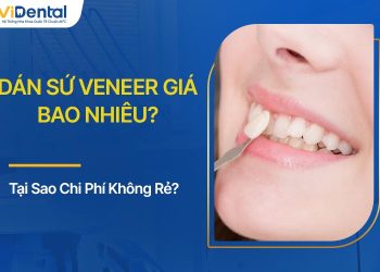 Dán Sứ Veneer Giá Bao Nhiêu? Tại Sao Chi Phí Không Rẻ?