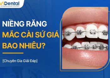 Niềng Răng Mắc Cài Sứ Giá Bao Nhiêu? Chuyên Gia Giải Đáp