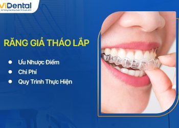 Răng Giả Tháo Lắp Là Gì? Ưu Nhược Điểm, Chi Phí Và Quy Trình