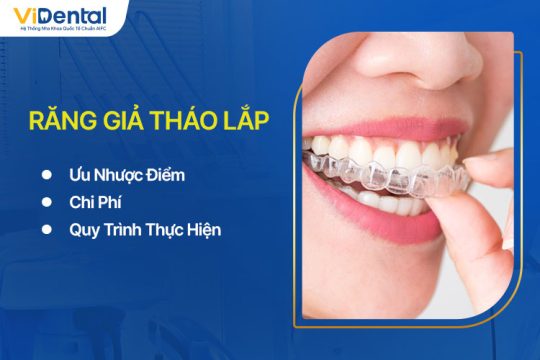 Răng Giả Tháo Lắp Là Gì? Ưu Nhược Điểm, Chi Phí Và Quy Trình