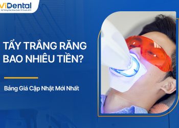 Tẩy Trắng Răng Bao Nhiêu Tiền? Bảng Giá Mới Nhất Hiện Nay