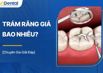 Trám Răng Giá Bao Nhiêu? Tác Hại Của Trám Răng Giá Rẻ