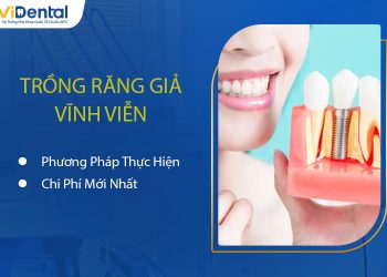 Trồng Răng Giả Vĩnh Viễn Gồm Kỹ Thuật Nào? Chi Phí Thực Hiện