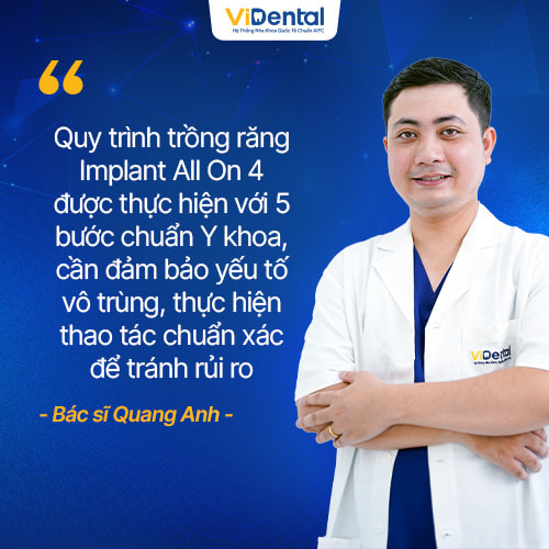 Quy trình trồng răng Implant All On 4 gồm 5 bước