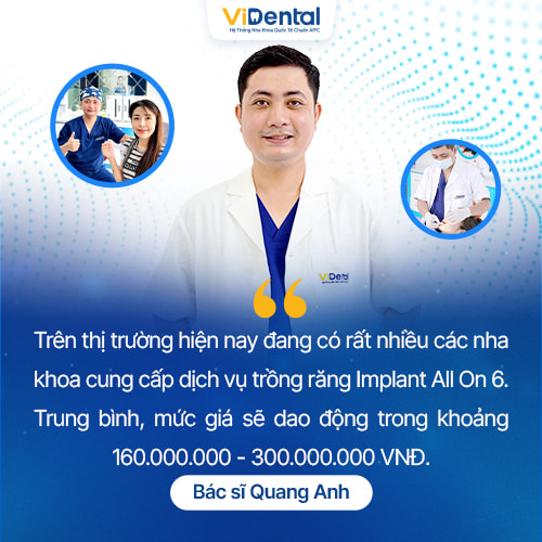 Trồng răng Implant All On 6 dao động trong khoảng 160.000.000 - 300.000.000 VNĐ