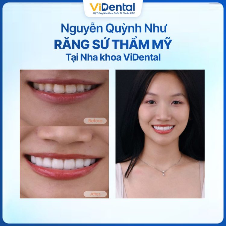 Khách Hàng Nguyễn Quỳnh Như