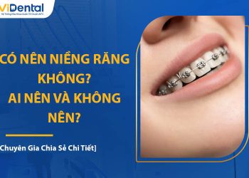 Có Nên Niềng Răng Không? Ai Nên Và Không Nên Thực Hiện?