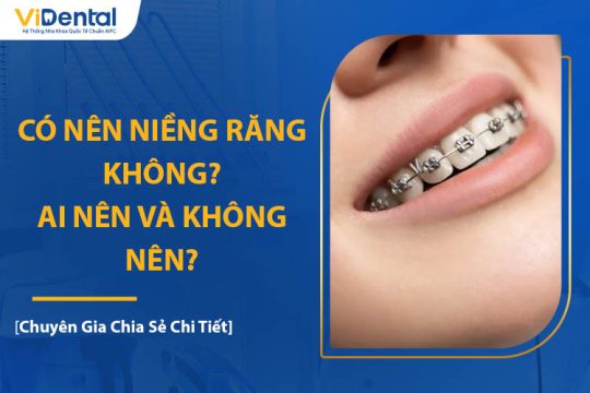 Có Nên Niềng Răng Không? Ai Nên Và Không Nên Thực Hiện?