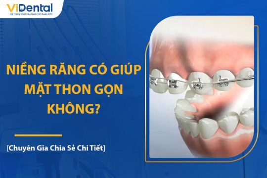 Niềng Răng Có Giúp Mặt Thon Gọn? Chuyên Gia Giải Đáp Chi Tiết