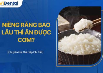 Niềng Răng Bao Lâu Thì Ăn Được Cơm? Chuyên Gia Giải Đáp