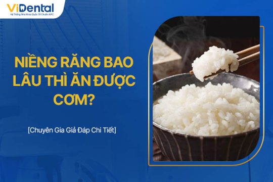 Niềng Răng Bao Lâu Thì Ăn Được Cơm? Chuyên Gia Giải Đáp