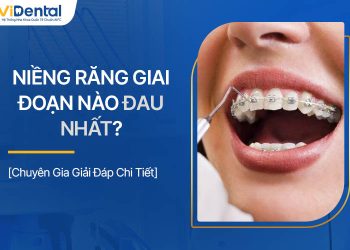 Niềng Răng Giai Đoạn Nào Đau Nhất? Làm Gì Để Giảm Đau?