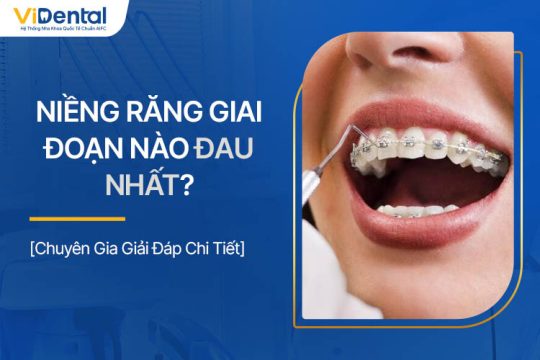 Niềng Răng Giai Đoạn Nào Đau Nhất? Làm Gì Để Giảm Đau?