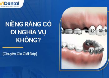 Nếu Niềng Răng Không Nhổ Răng Có Hiệu Quả Không? 