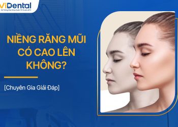 Niềng Răng Mũi Có Cao Lên Không? Giải Đáp Chi Tiết