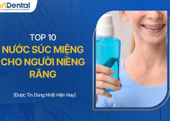 Top 10 Nước Súc Miệng Cho Người Niềng Răng Chất Lượng