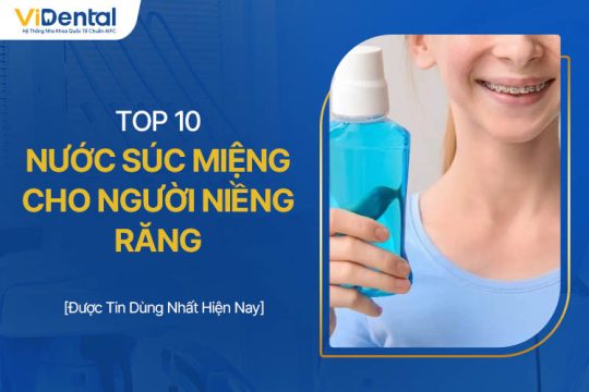 Top 10 Nước Súc Miệng Cho Người Niềng Răng Chất Lượng