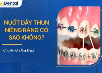 Nuốt Dây Thun Niềng Răng Có Sao Không? Cách Xử Lý Tốt Nhất