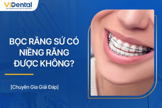 Bọc Răng Sứ Có Niềng Răng Được Không? Cần Chú Ý Gì?